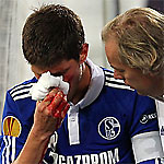 �����-�� �������� ������� ������ � ����� ������ ����